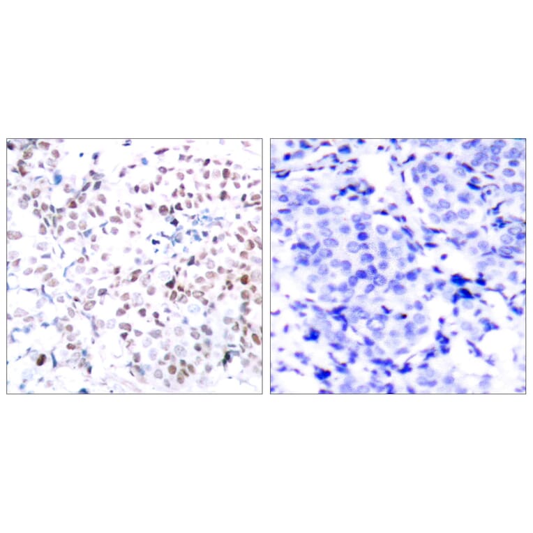 Immunohistochemistry - Anti-Myc (phospho Thr358) Antibody (A7158) - Antibodies.com