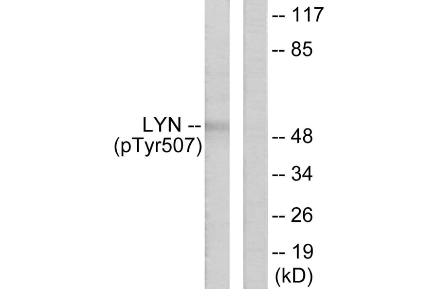 Western Blot - Anti-Lyn (phospho Tyr507) Antibody (A0076) - Antibodies.com