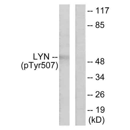 Western Blot - Anti-Lyn (phospho Tyr507) Antibody (A0076) - Antibodies.com
