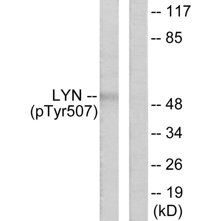 Western Blot - Anti-Lyn (phospho Tyr507) Antibody (A0076) - Antibodies.com