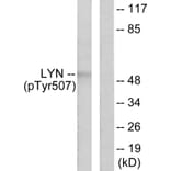 Western Blot - Anti-Lyn (phospho Tyr507) Antibody (A0076) - Antibodies.com