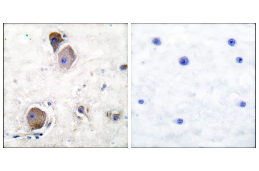 Immunohistochemistry - Anti-Lyn (phospho Tyr507) Antibody (A0076) - Antibodies.com