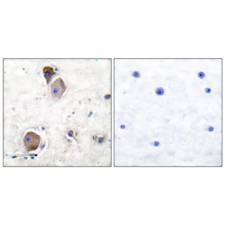 Immunohistochemistry - Anti-Lyn (phospho Tyr507) Antibody (A0076) - Antibodies.com