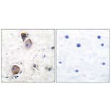 Immunohistochemistry - Anti-Lyn (phospho Tyr507) Antibody (A0076) - Antibodies.com