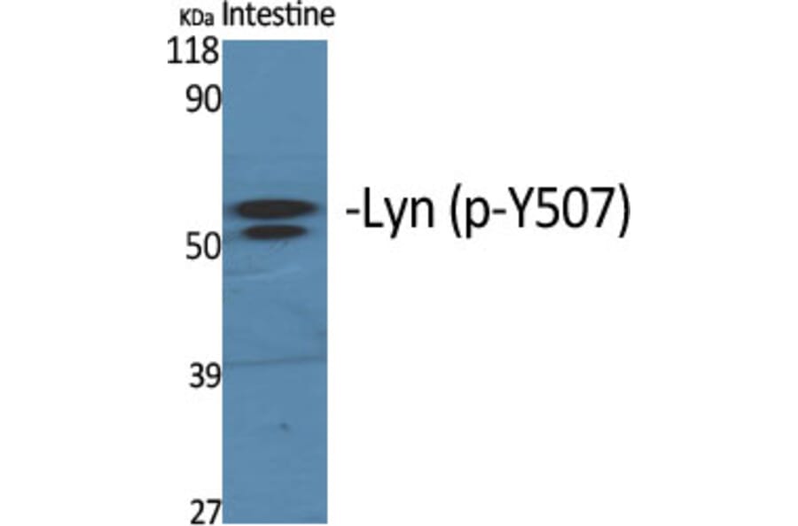 Western Blot - Anti-Lyn (phospho Tyr507) Antibody (A0076) - Antibodies.com