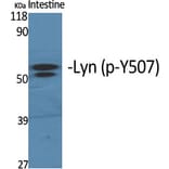 Western Blot - Anti-Lyn (phospho Tyr507) Antibody (A0076) - Antibodies.com