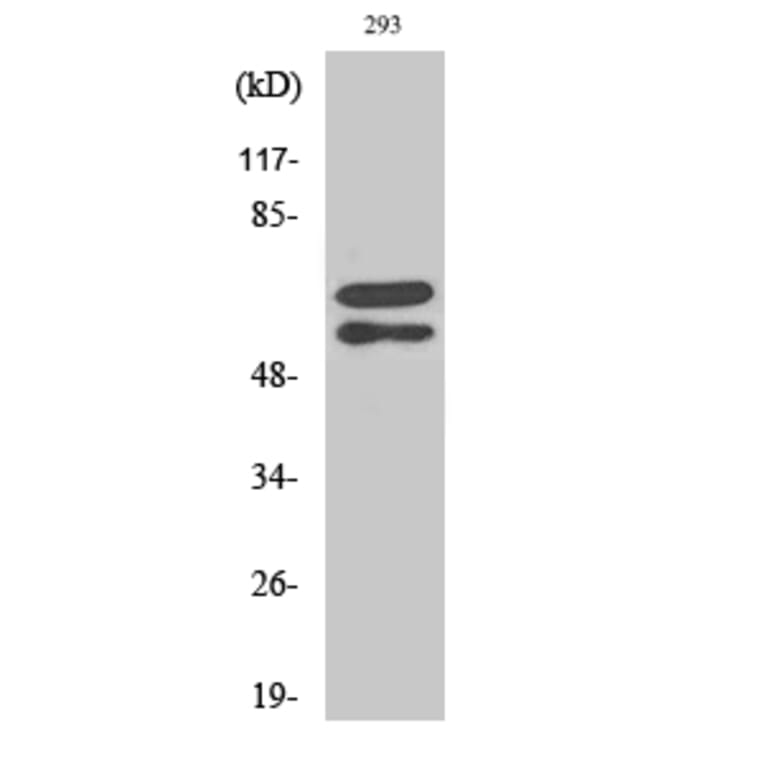 Western Blot - Anti-Lyn (phospho Tyr507) Antibody (A0076) - Antibodies.com