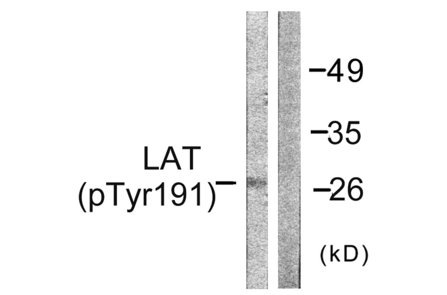 Western Blot - Anti-LAT (phospho Tyr191) Antibody (A0504) - Antibodies.com