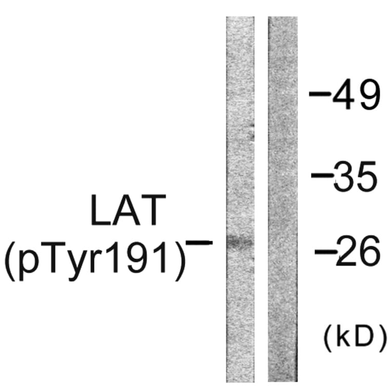 Western Blot - Anti-LAT (phospho Tyr191) Antibody (A0504) - Antibodies.com