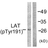 Western Blot - Anti-LAT (phospho Tyr191) Antibody (A0504) - Antibodies.com