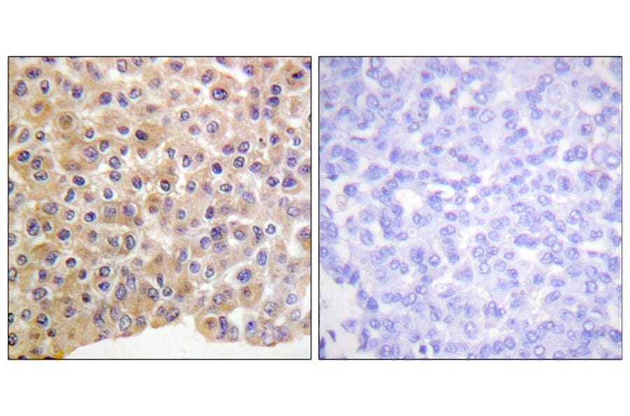 Immunohistochemistry - Anti-IR (phospho Tyr1361) Antibody (A0494) - Antibodies.com