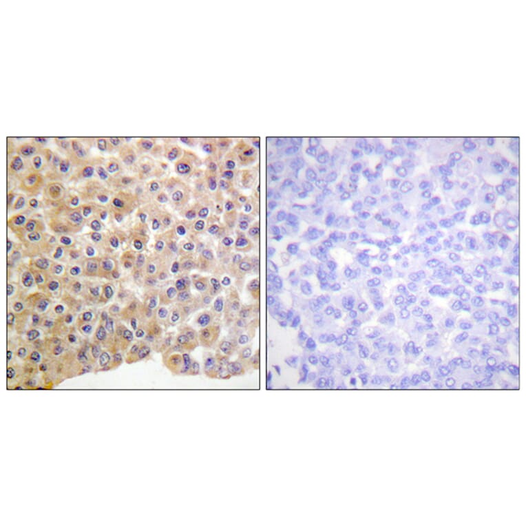 Immunohistochemistry - Anti-IR (phospho Tyr1361) Antibody (A0494) - Antibodies.com