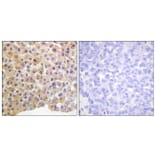 Immunohistochemistry - Anti-IR (phospho Tyr1361) Antibody (A0494) - Antibodies.com