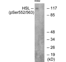 Western Blot - Anti-HSL (phospho Ser552) Antibody (A0437) - Antibodies.com