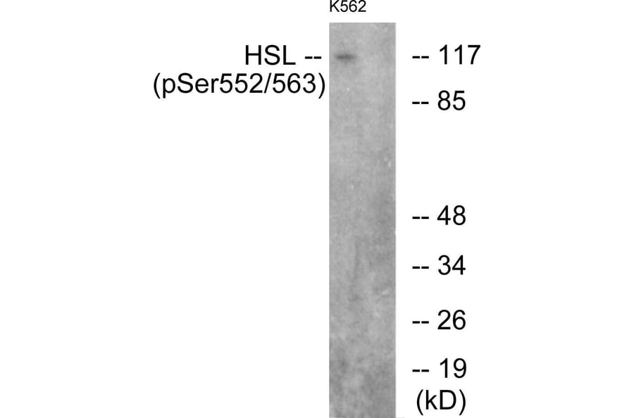 Western Blot - Anti-HSL (phospho Ser552) Antibody (A0437) - Antibodies.com