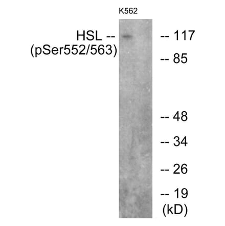 Western Blot - Anti-HSL (phospho Ser552) Antibody (A0437) - Antibodies.com