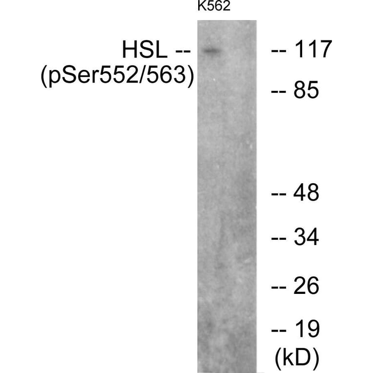 Western Blot - Anti-HSL (phospho Ser552) Antibody (A0437) - Antibodies.com