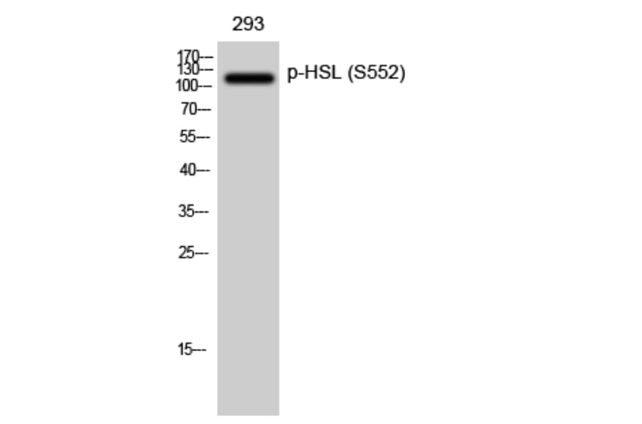 Western Blot - Anti-HSL (phospho Ser552) Antibody (A0437) - Antibodies.com