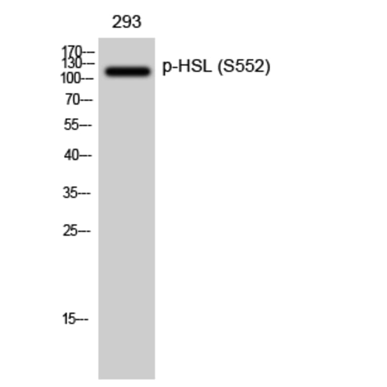 Western Blot - Anti-HSL (phospho Ser552) Antibody (A0437) - Antibodies.com