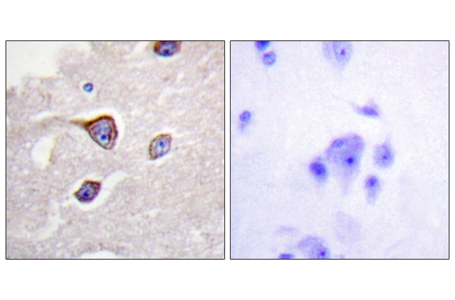 Immunohistochemistry - Anti-GRK1 (phospho Ser21) Antibody (A0937) - Antibodies.com
