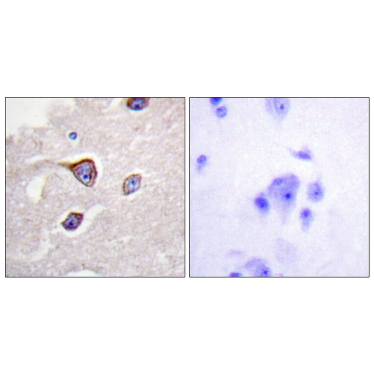 Immunohistochemistry - Anti-GRK1 (phospho Ser21) Antibody (A0937) - Antibodies.com