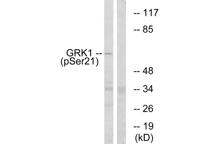 Western Blot - Anti-GRK1 (phospho Ser21) Antibody (A0937) - Antibodies.com