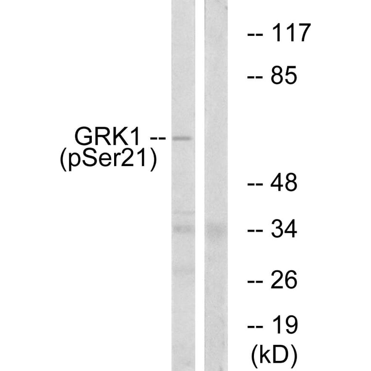 Western Blot - Anti-GRK1 (phospho Ser21) Antibody (A0937) - Antibodies.com