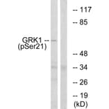 Western Blot - Anti-GRK1 (phospho Ser21) Antibody (A0937) - Antibodies.com