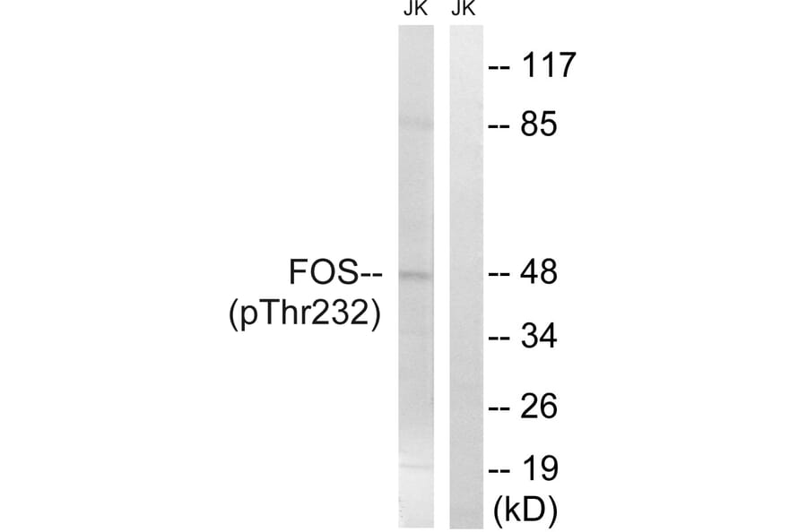 Western Blot - Anti-FOS (phospho Thr232) Antibody (A8226) - Antibodies.com