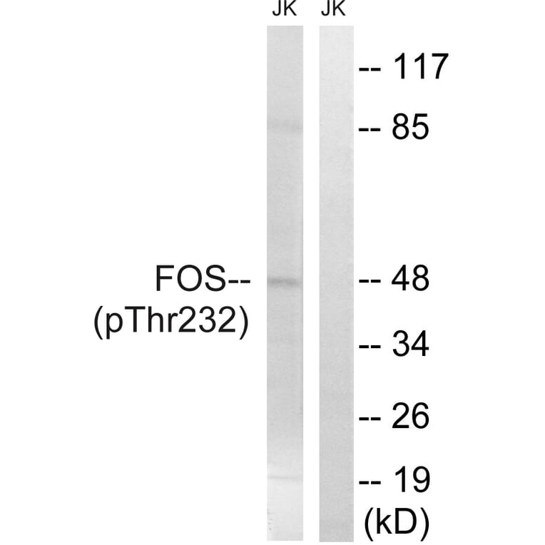 Western Blot - Anti-FOS (phospho Thr232) Antibody (A8226) - Antibodies.com