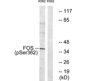 Western Blot - Anti-Fos (phospho Ser362) Antibody (A0429) - Antibodies.com