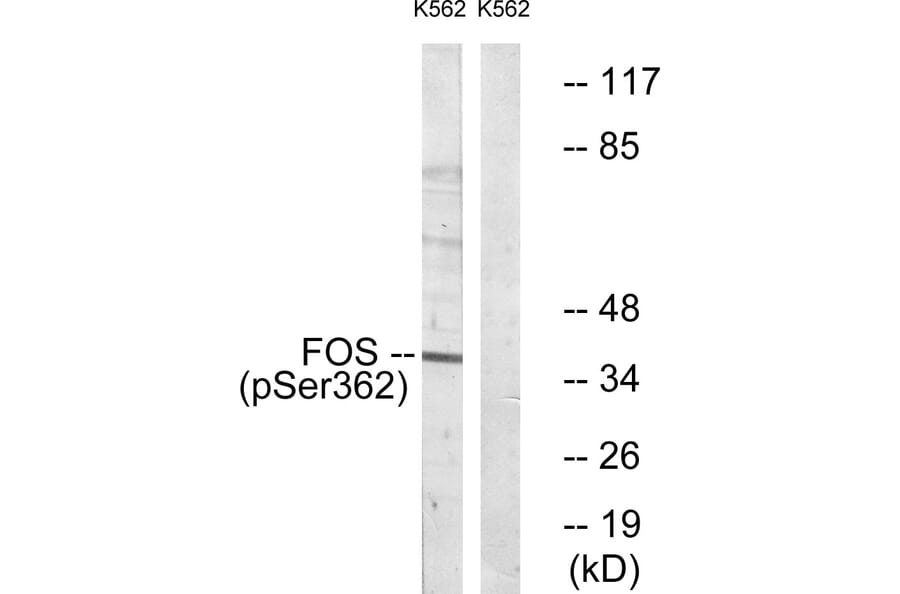 Western Blot - Anti-Fos (phospho Ser362) Antibody (A0429) - Antibodies.com