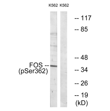Western Blot - Anti-Fos (phospho Ser362) Antibody (A0429) - Antibodies.com