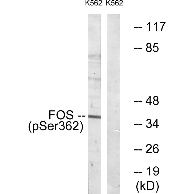 Western Blot - Anti-Fos (phospho Ser362) Antibody (A0429) - Antibodies.com