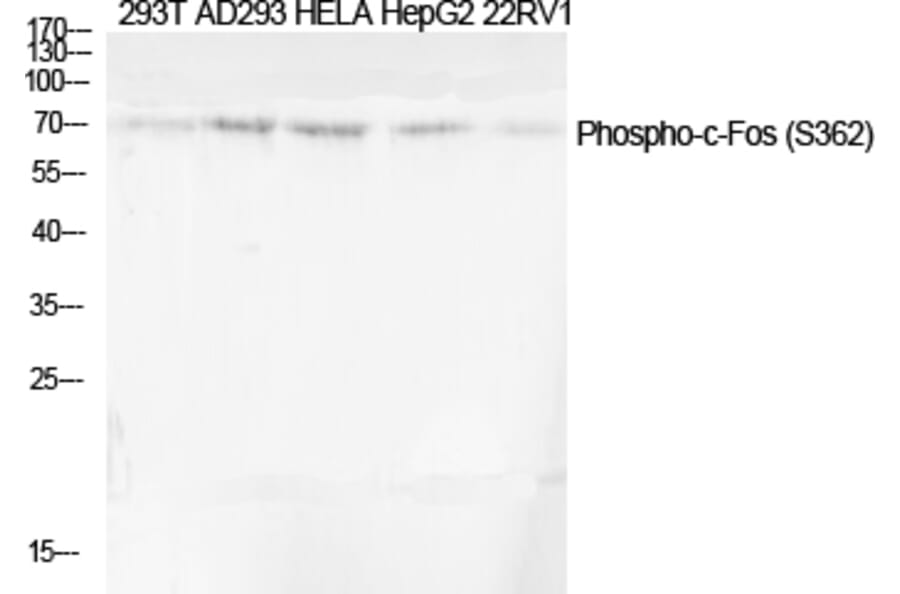 Western Blot - Anti-Fos (phospho Ser362) Antibody (A0429) - Antibodies.com