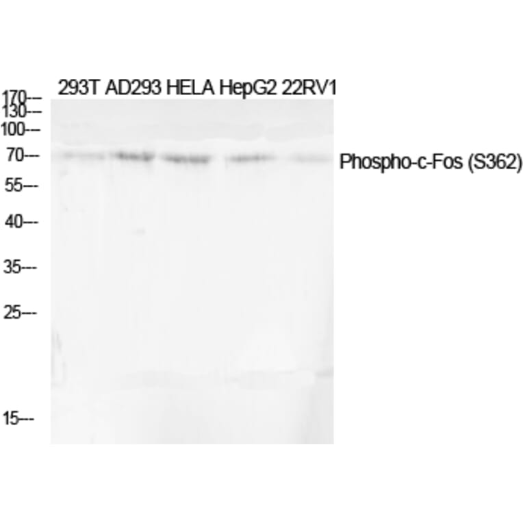 Western Blot - Anti-Fos (phospho Ser362) Antibody (A0429) - Antibodies.com