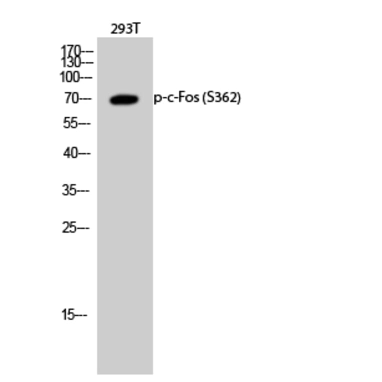 Western Blot - Anti-Fos (phospho Ser362) Antibody (A0429) - Antibodies.com