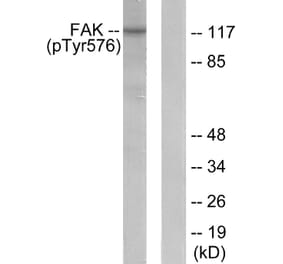 Western Blot - Anti-FAK (phospho Tyr576) Antibody (A0426) - Antibodies.com