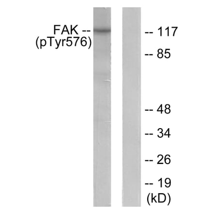 Western Blot - Anti-FAK (phospho Tyr576) Antibody (A0426) - Antibodies.com