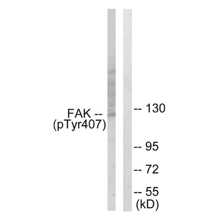 Western Blot - Anti-FAK (phospho Tyr407) Antibody (A0479) - Antibodies.com