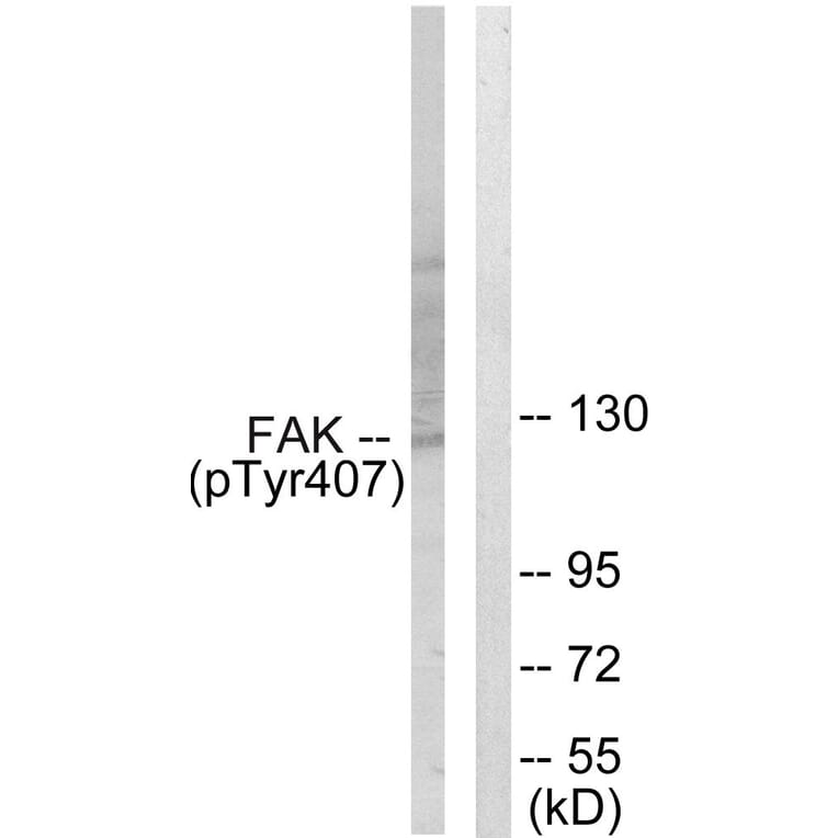 Western Blot - Anti-FAK (phospho Tyr407) Antibody (A0479) - Antibodies.com