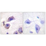 Immunohistochemistry - Anti-FAK (phospho Tyr407) Antibody (A0479) - Antibodies.com