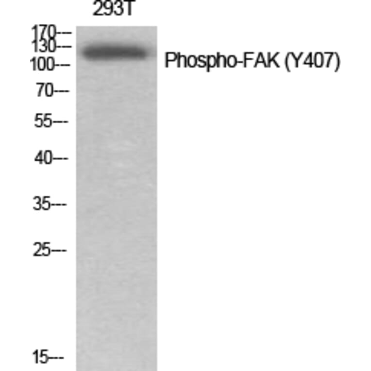 Western Blot - Anti-FAK (phospho Tyr407) Antibody (A0479) - Antibodies.com