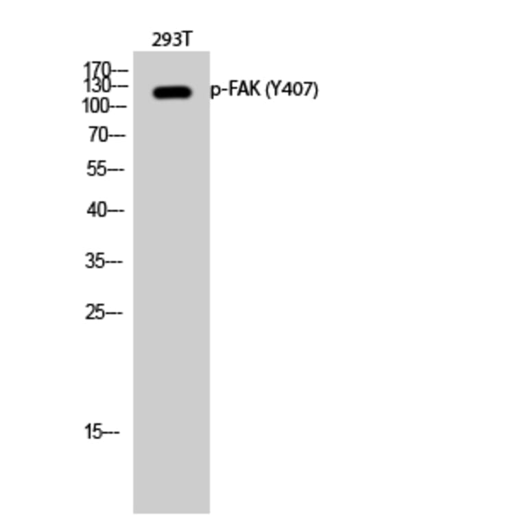 Western Blot - Anti-FAK (phospho Tyr407) Antibody (A0479) - Antibodies.com