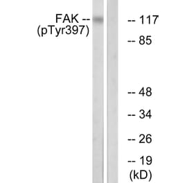 Western Blot - Anti-FAK (phospho Tyr397) Antibody (A0925) - Antibodies.com
