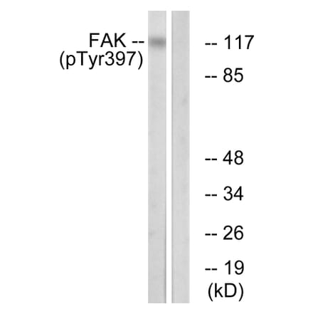 Western Blot - Anti-FAK (phospho Tyr397) Antibody (A0925) - Antibodies.com
