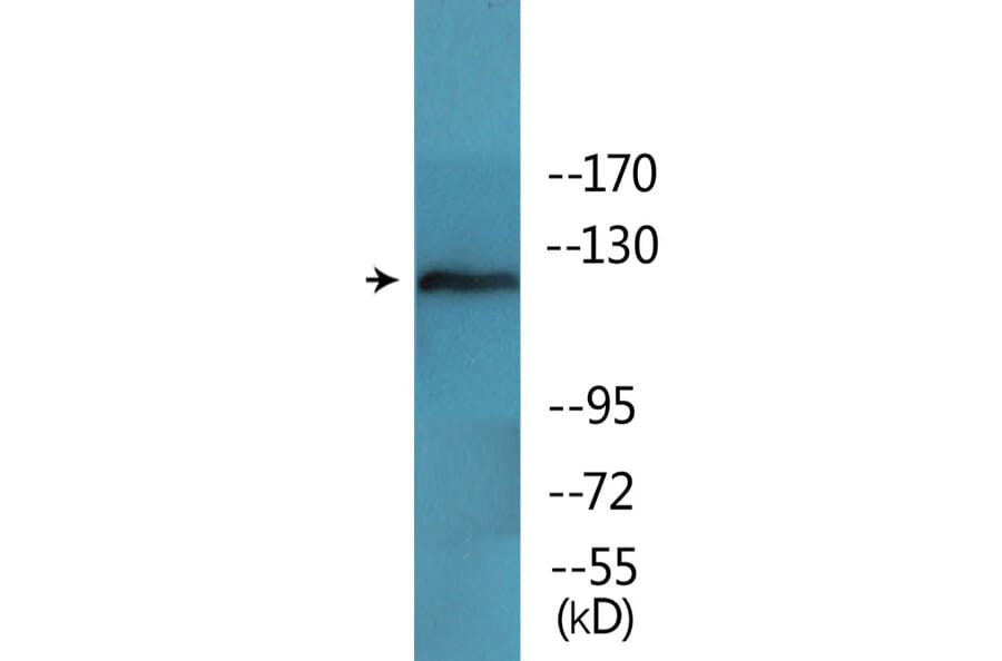 Western Blot - Anti-FAK (phospho Tyr397) Antibody (P12-1104) - Antibodies.com