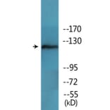 Western Blot - Anti-FAK (phospho Tyr397) Antibody (P12-1104) - Antibodies.com