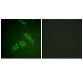 Immunofluorescence - Anti-FAK (phospho Ser910) Antibody (A0924) - Antibodies.com