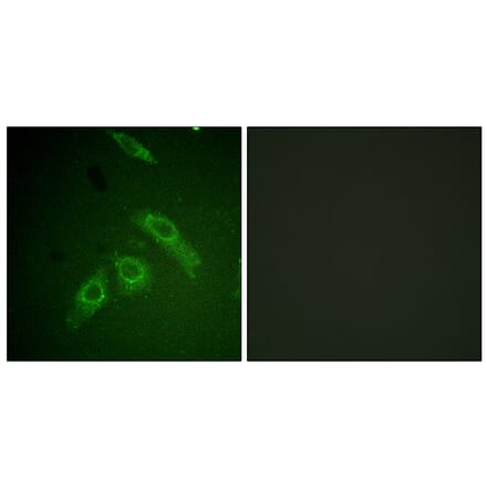 Immunofluorescence - Anti-FAK (phospho Ser910) Antibody (A0924) - Antibodies.com